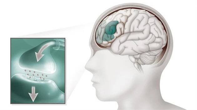 ADHD u dospělých: 5 tipů, jak zvládnout den bez chaosu - iDNES.cz