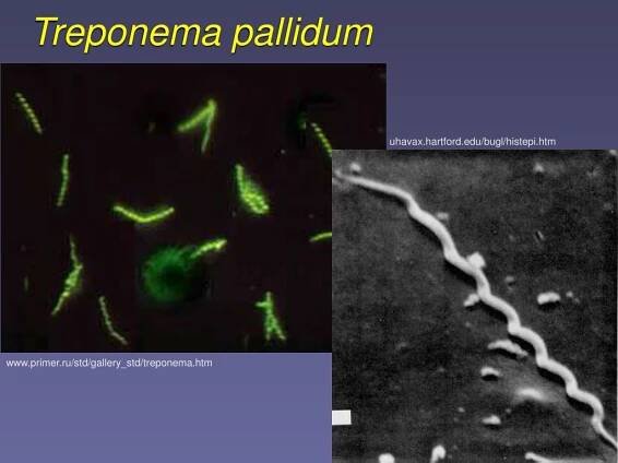 PPT - Lékařská mikrobiologie pro ZDRL PowerPoint Presentation, free download - ID:3576725