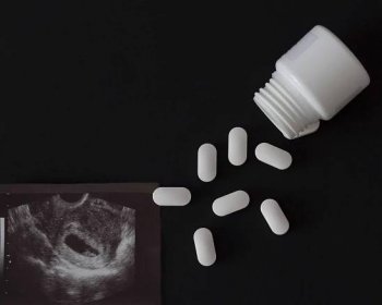 Potratovou pilulku využívá stále víc žen. Může za to i pandemie covidu
