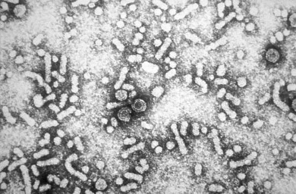 Hepatitida B