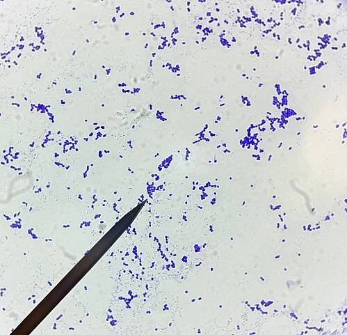 Acinetobacter baylyi