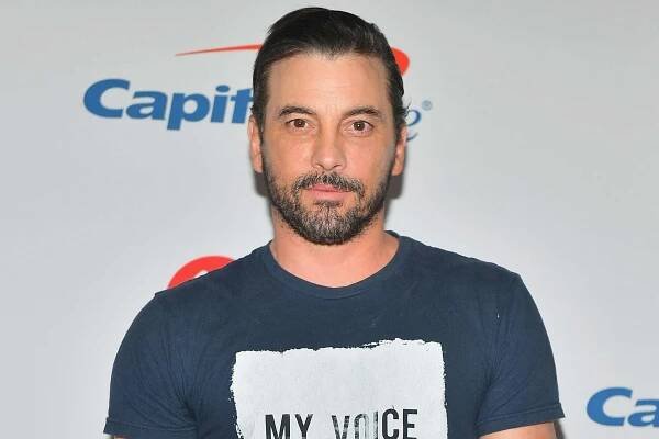 Skeet Ulrich Gives a 'Rare Look' Inside His Open Heart Surgery Nearly 40 Years Ago with Graphic Photo