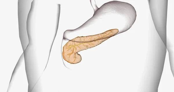 Cystic fibrosis (CF) is a genetic disorder characterized by thick mucus production. 3D rendering — Stock obrázek