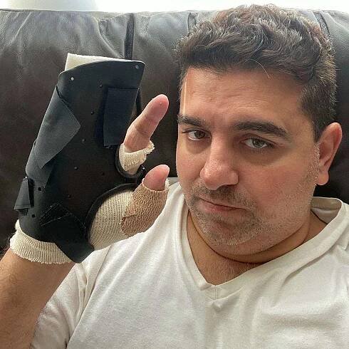 Buddy Valastro Says the Nerve in His Hand 'Feels Back to Normal' 1 Year After Gruesome Injury