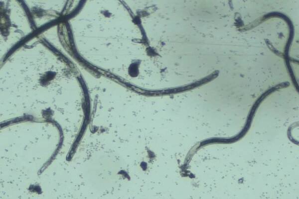 microscopic plant parasitic nematodes