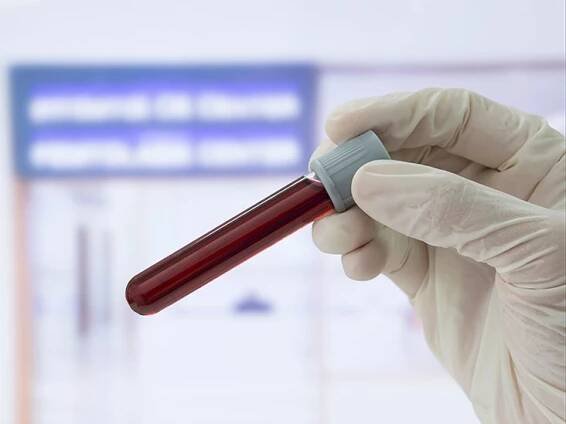 Serum Hemoglobin Test: Uses, Procedures, and Risks