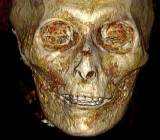 Digital Scan of Ancient Egyptian Mummy Amenhotep I Shows His True Face
