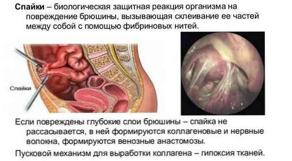 Bolest břicha kolem pupku, co dělat, možné příčiny / Gastroenterologie | Užitečné informace a tipy na péči o sebe. Zdraví