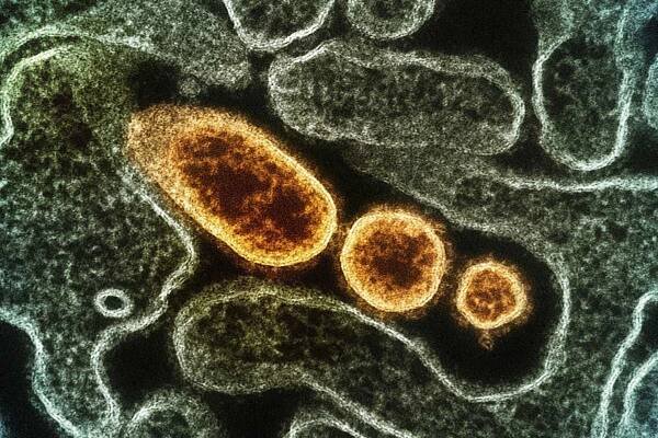 Nipah Virus Particles Colorized transmission electron micrograph of mature extracellular Nipah virus particles (gold) near the periphery of an infected VERO cell (green). Credit: NIAID/Unsplash