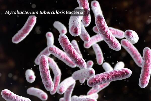 Tuberculosis (TB)