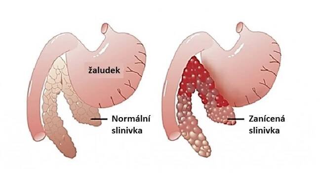 Akutní pankreatitida psů a koček | Moderní veterina na Praze 4 - Veterinární klinika Vethope