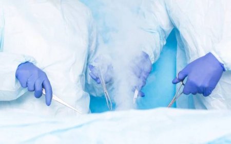 dva chirurgové hiurge provést operaci pomocí tekuté dusíkové kryoterapie k odstranění maligních nádorů, nádorů. moderní metoda léčby kryochirurgie, hemoroidy - bazaliom - stock snímky, obrázky a fotky