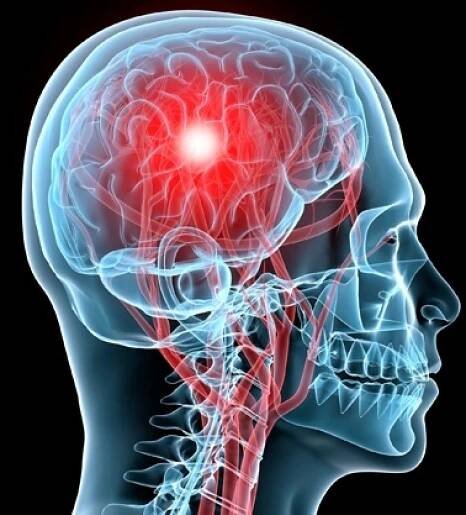 Vestibular / Concussion - BedfordPT