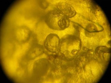 Soubor:Mikroskopický snímek smrkance se vzduchovými bublinami.jpg – Wikipedie