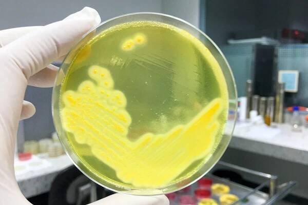 Staphylococcus aureus – Was ist das genau?