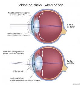 Akomodácia oka - príznaky a liečba