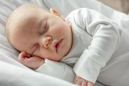 seboroická dermatitida na obličeji dítěte. spící novorozené dítě se seborrheou na čele - seboroická dermatitida - stock snímky, obrázky a fotky