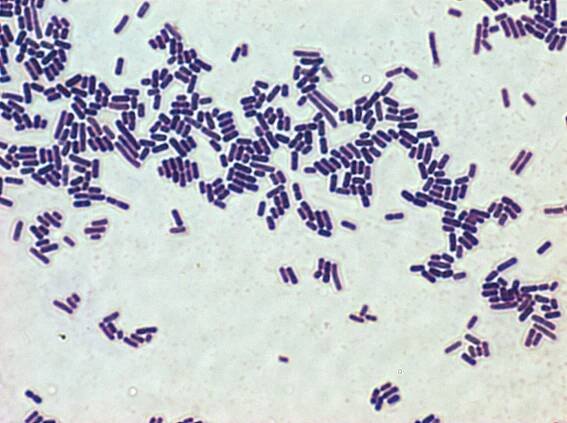Bacteria and Your Bourbon | The Bourbon Review