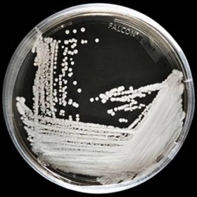 Nová příšera: Superkvasinka Candida auris je na počátku globální epidemie