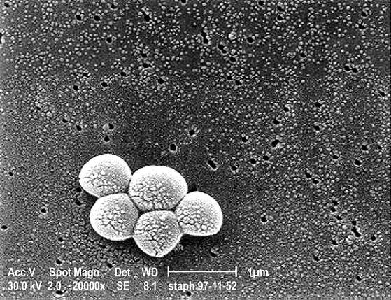mikrofotografie, seskupování, meticilin rezistentní staphylococcus aureus, mrsa, bakterie