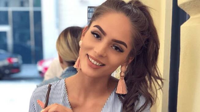FOTO: Instagramová celebrita Týnuš Třešničková ukázala své popáleniny!