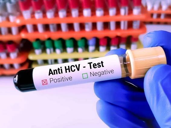 Hepatitis C Infection: All You Need to Know