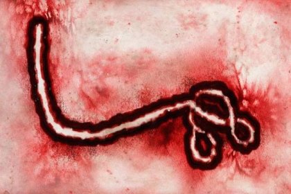 Stáhnout - Zobrazit virus Ebola pod mikroskopem — Stock obrázek