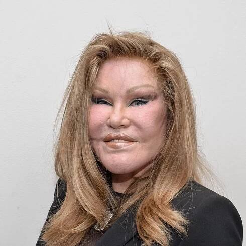 'Catwoman' Jocelyn Wildenstein, famed for extreme plastic surgery, dies at 84