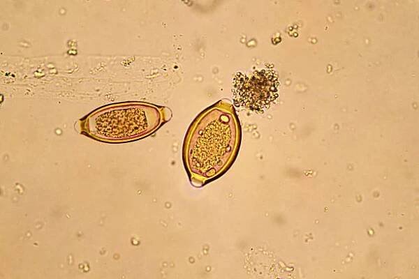 trichuris trichiura - roupi - stock snímky, obrázky a fotky