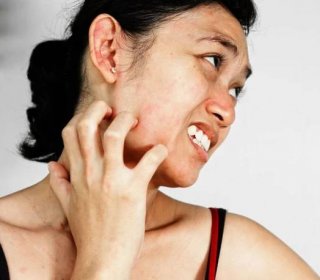 Cítíte často potřebu se škrábat na obličeji? Jaké jsou příčiny a co se dá dělat