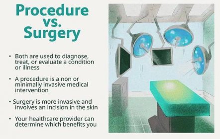 An illustration with information about procedure vs. surgery