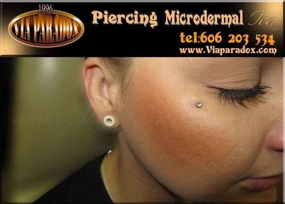 Microdermal - Via Paradox