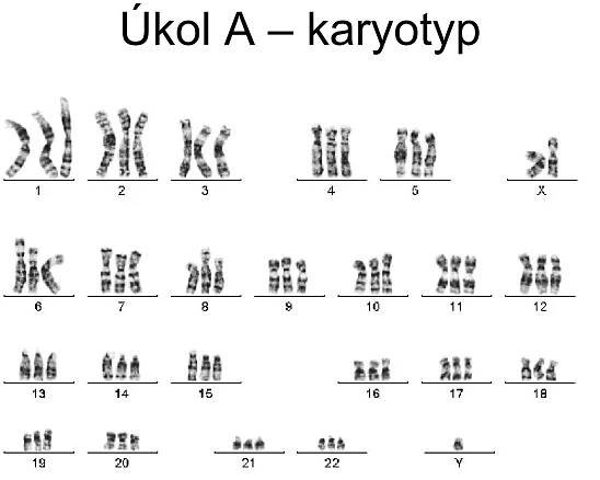 Úkol A – karyotyp 