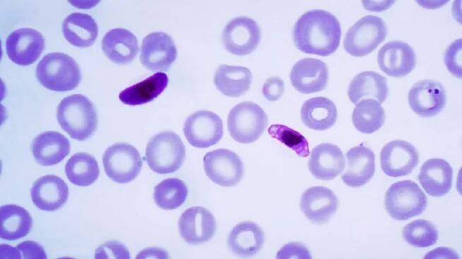 Malárie zmutovala a začala unikat testům. WHO doporučuje bedlivější dohled