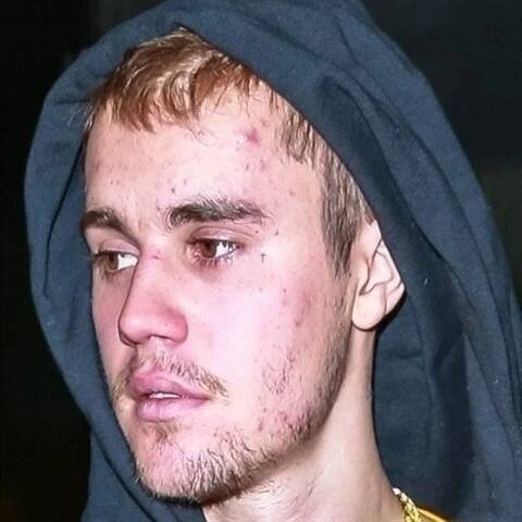 Justin Bieber, kdysi ikona dospívajících dívek, dnes vypadá jako ukázkový feťák.