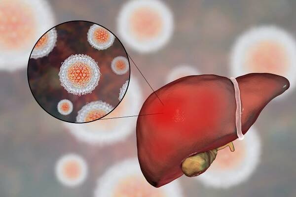 Hepatitída - Superionherbs.SK