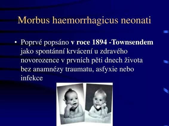PPT - Projevy a prevence hemoragické nemoci novorozence PowerPoint Presentation - ID:4192212