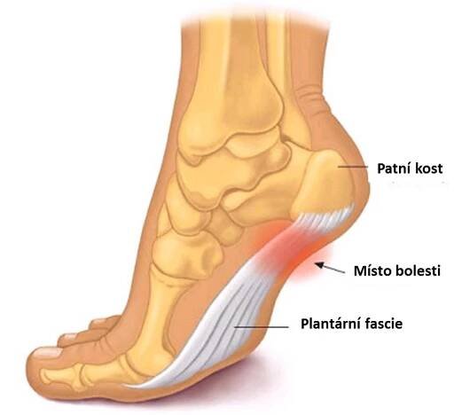 pata a plantarni fascie