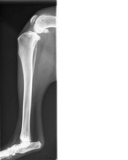 Kniegelenk mit Arthrose