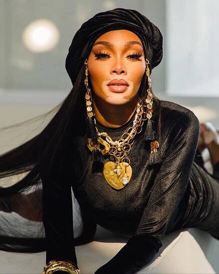 Winnie Harlow