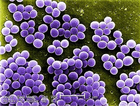 Staphylococcus aureus - Quip Labs