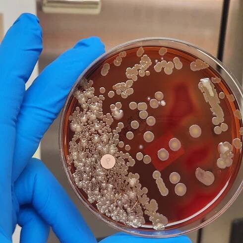 Bakterie Acinetobacter a její význam pro zdraví