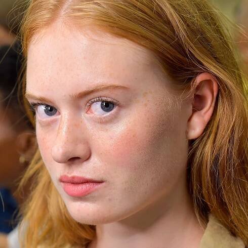Accutane Side Effects: 9 Things to Know About the Acne Treatment