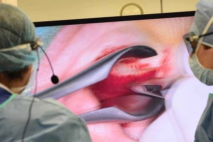Lékaři z celé republiky se sjeli do Svitav na kurz chirurgie středního ucha.