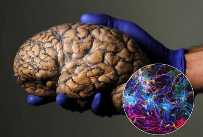 Nově objevené geny mohou za to, že lidé mají tak veliký mozek | 100+1 zahraniční zajímavost