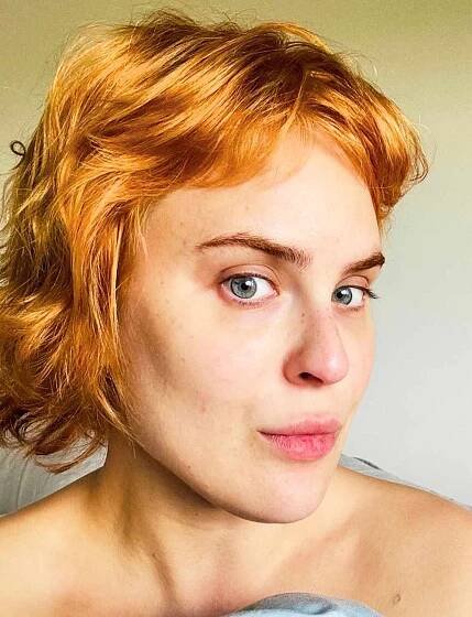Tallulah Willis Has Fillers Dissolved, Says She Hasn't Seen Her 'Real Bone Structure' in 6 Years