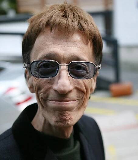 Robin Gibb z Bee Gees se musí znovu učit chodit a jíst – Dáma.cz