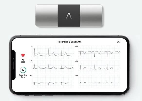 KardiaMobile 6L měří EKG přesněji než chytré hodinky. Odhalí fibrilaci síní, bradykardii i tachykardii