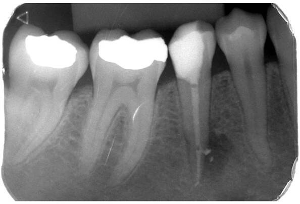 Naše práce - Zubní klinika SMILE FACTORY