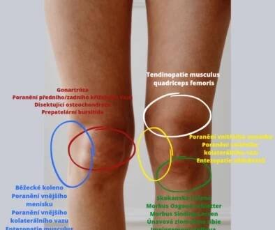 Krejčovský sval bolest: příčiny, symptomy a léčba